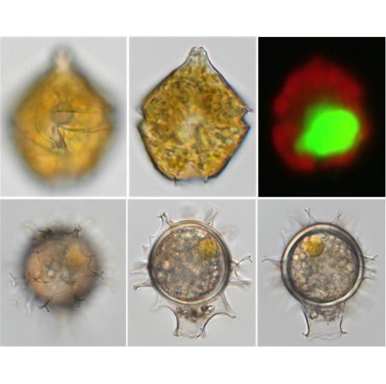 군산서 신종 해양플랑크톤 발견…"마약성 진통제 대체" 대표 이미지